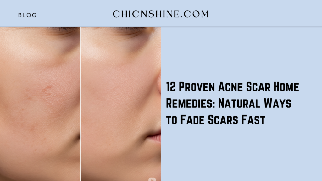 12 Proven Acne Scar Home Remedies: Natural Ways to Fade Scars Fast